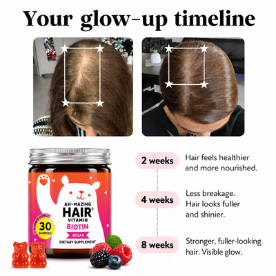 Biotin Gummies for Hair, Skin & Nails | 5000 mcg Biotin + Vitamins C & E + Zinc