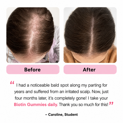 Biotin Gummies for Hair, Skin & Nails | 5000 mcg Biotin + Vitamins C & E + Zinc