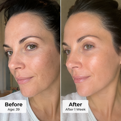 PDRN Exosome Skinplaning Glaze Mask