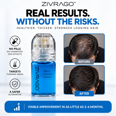 The Follicle-Targeted Peptide Infusion Hair Regrowth System