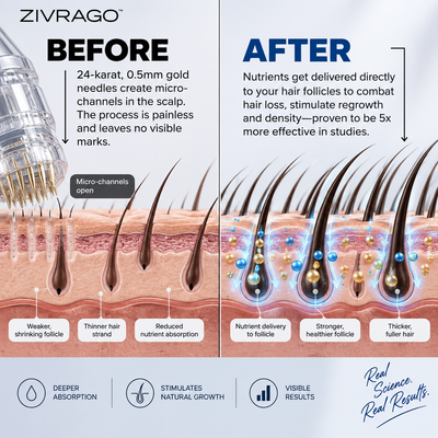 The Follicle-Targeted Peptide Infusion Hair Regrowth System