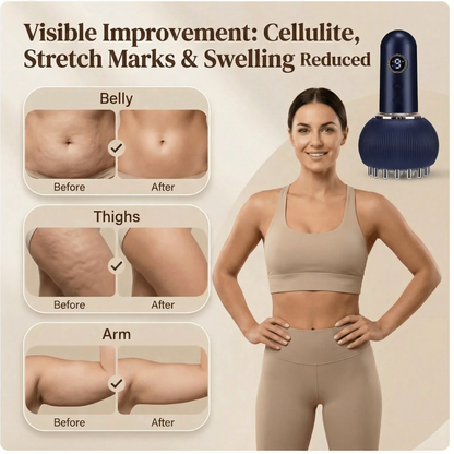 LumaSculpt™ Red Light Body Shaper